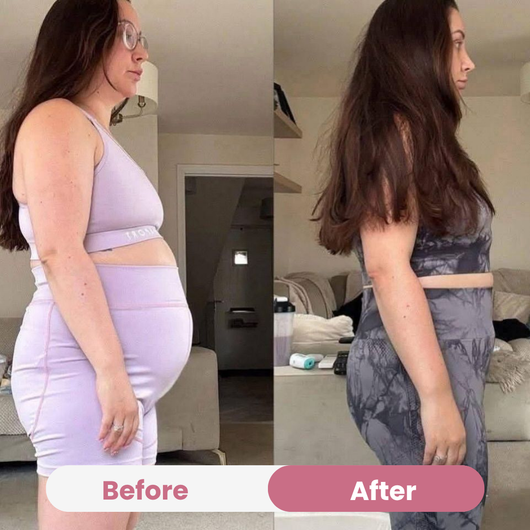 BloatEase+ Daily Debloat & Gut Balance Capsules